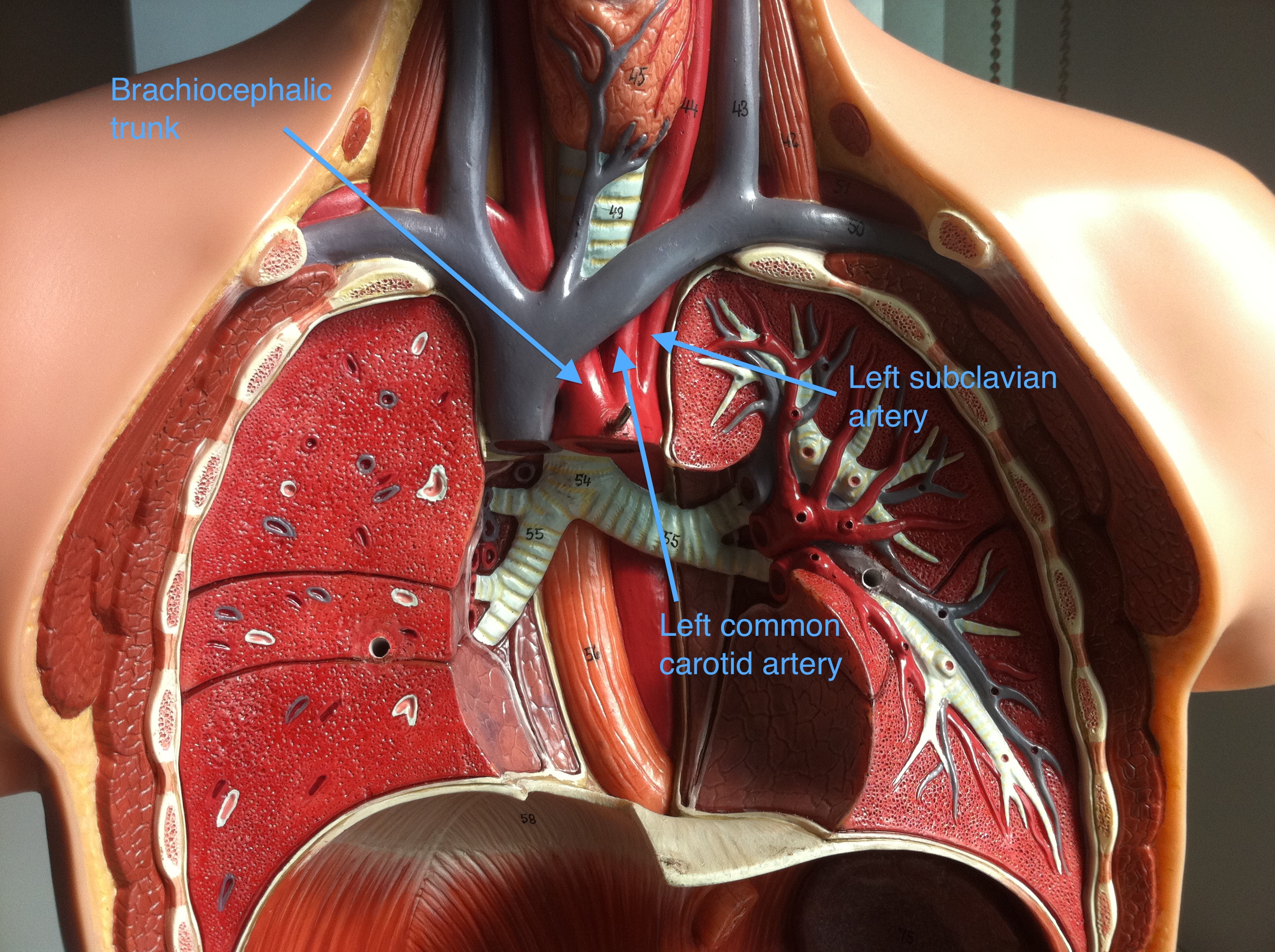 internal carotid artery model